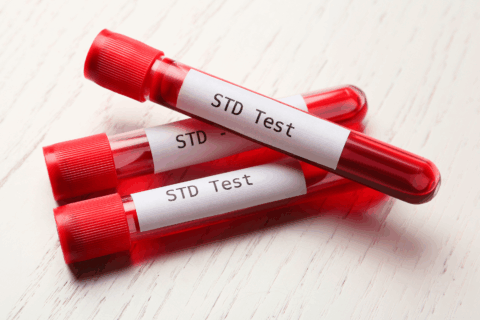 STD Testing and Treatment